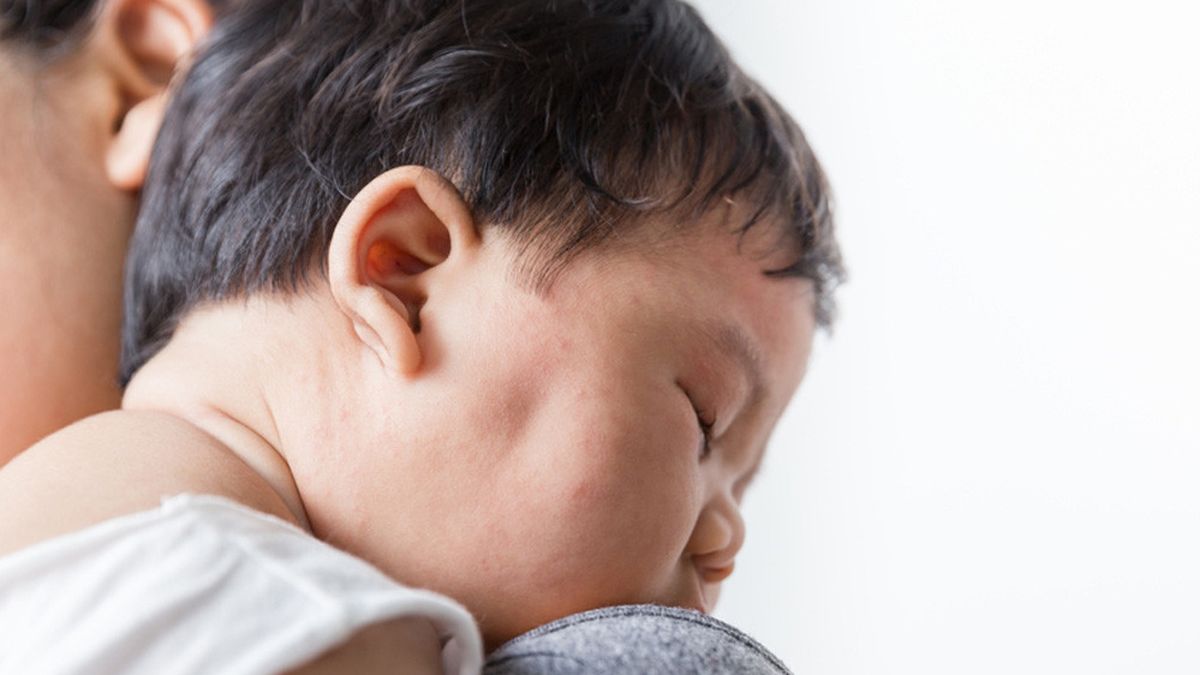 7 Cara Mengatasi Biang Keringat pada Bayi dan Penyebabnya