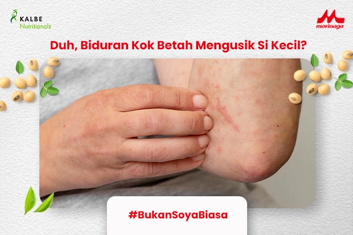 obat biduran alami