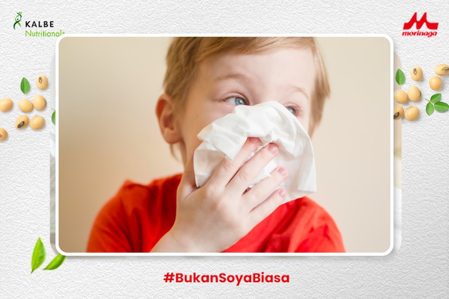 anak menunjukkan gejala alergi pada kulit