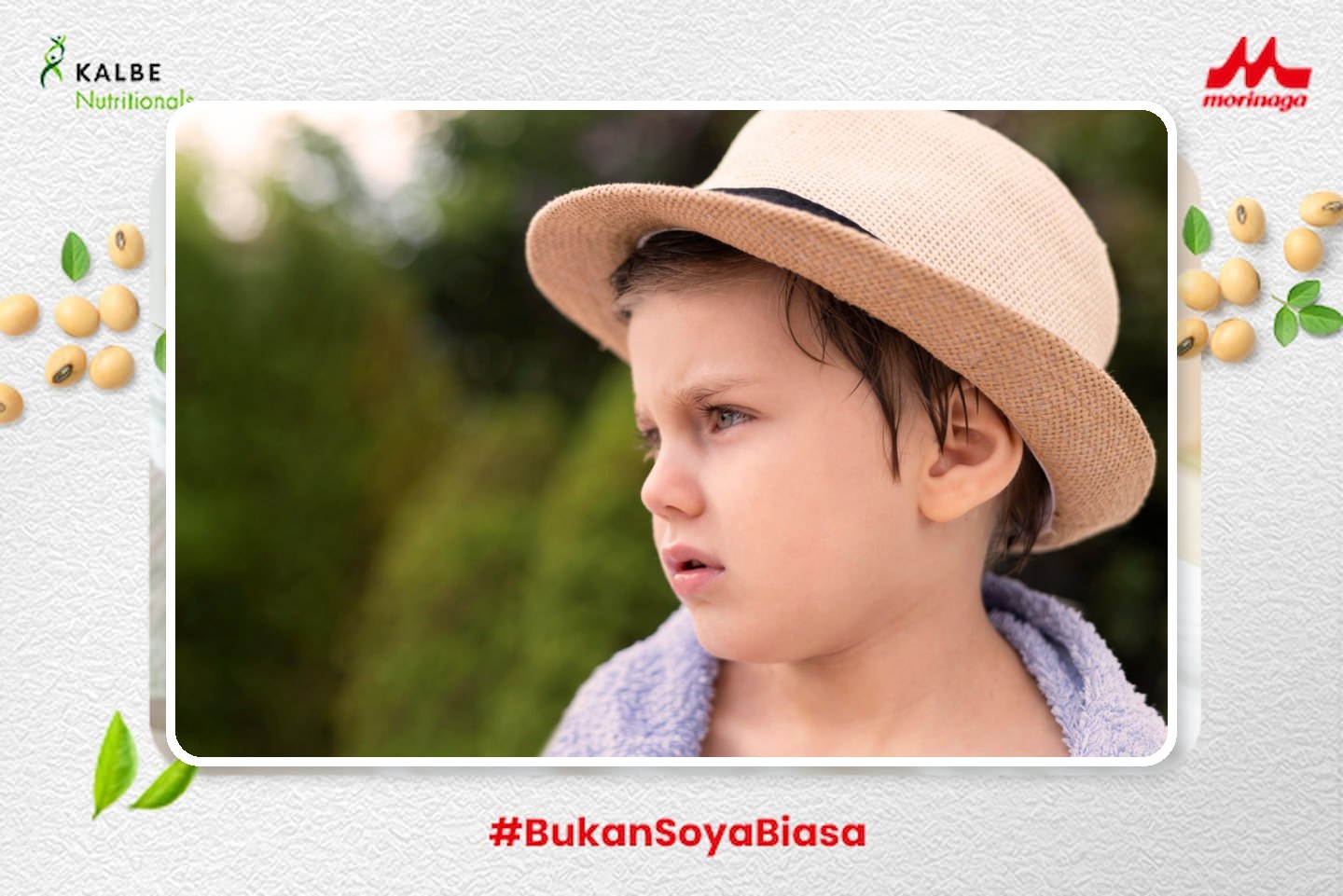 anak biduran akibat kepanasan