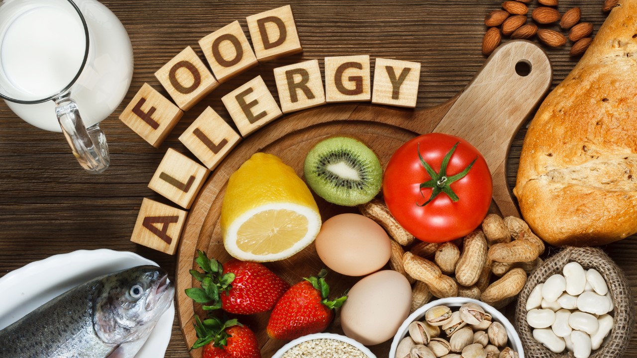 4 Cara Mengatasi Alergi Makanan pada Si Kecil