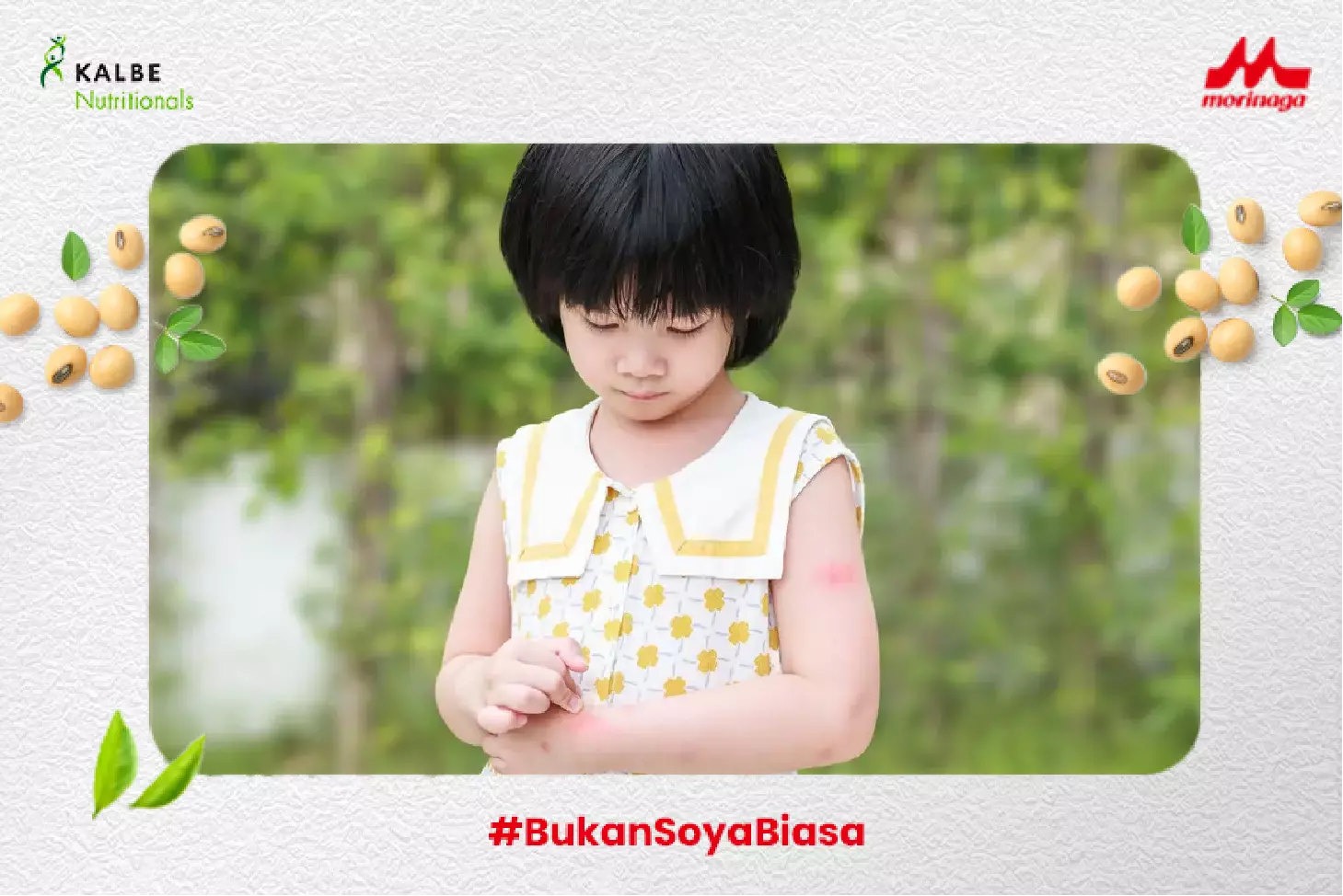 alergi gigitan nyamuk