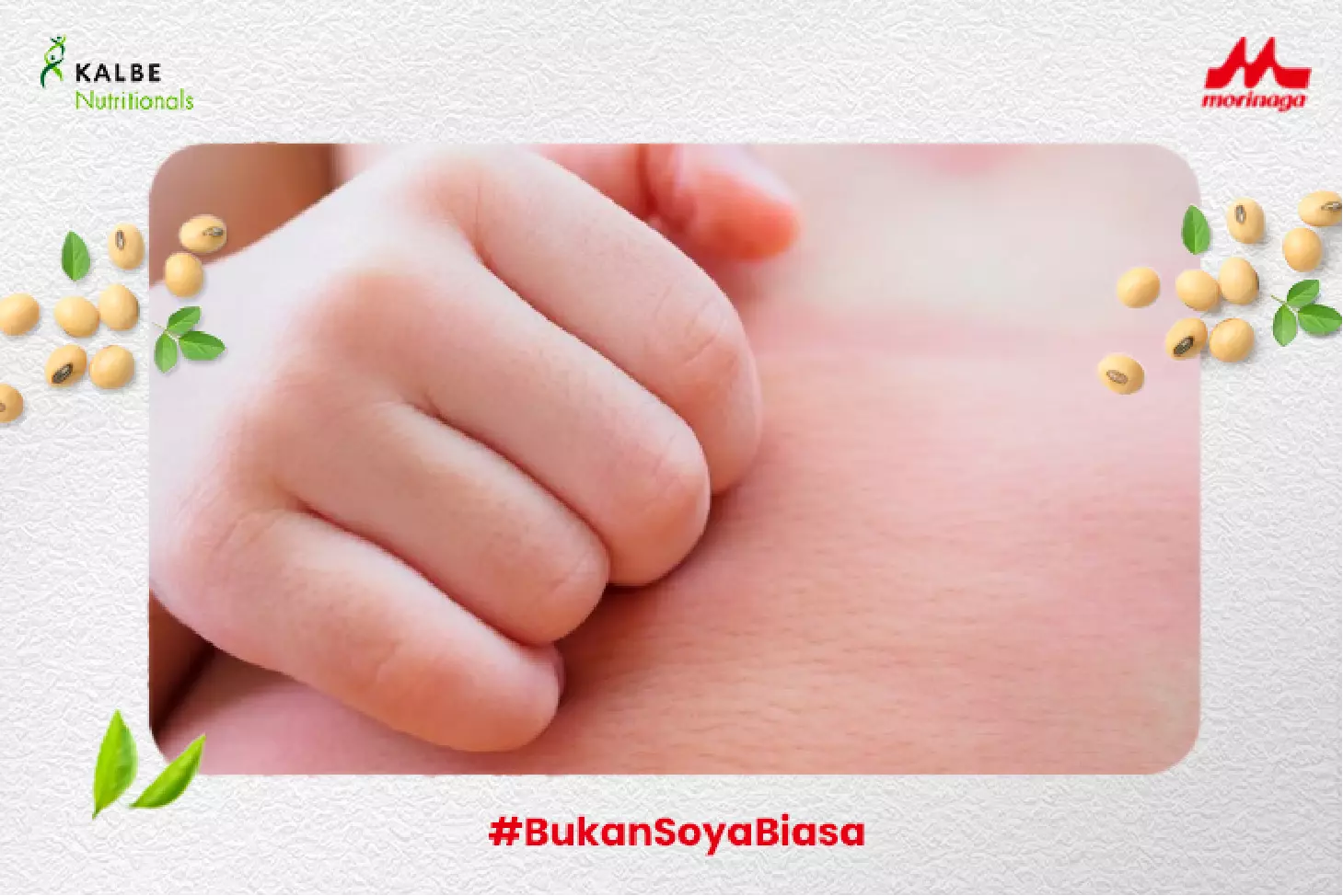 Ruam Akibat Alergi pada Bayi