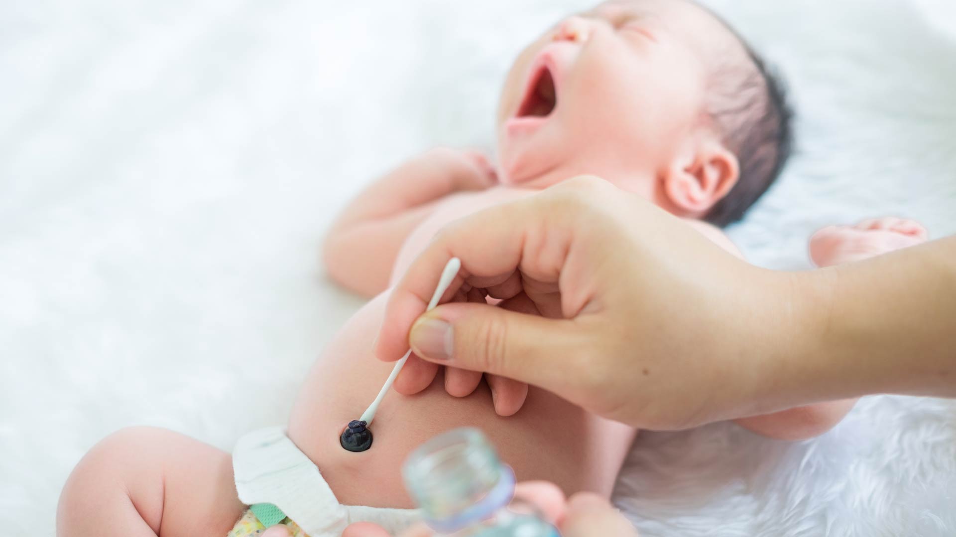 Cara Perawatan Tali Pusat Si Kecil Saat Baru Lahir