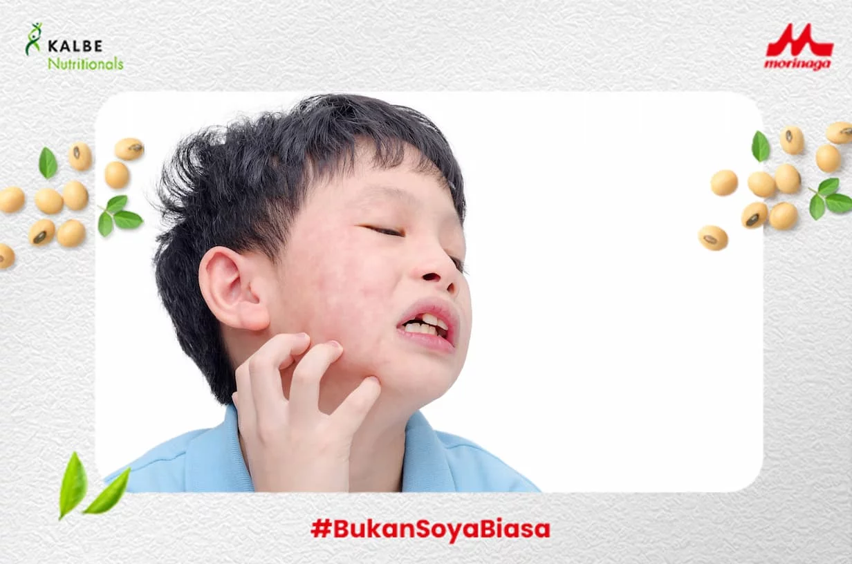 ciri ciri alergi air pada anak dan cara mengatasinya