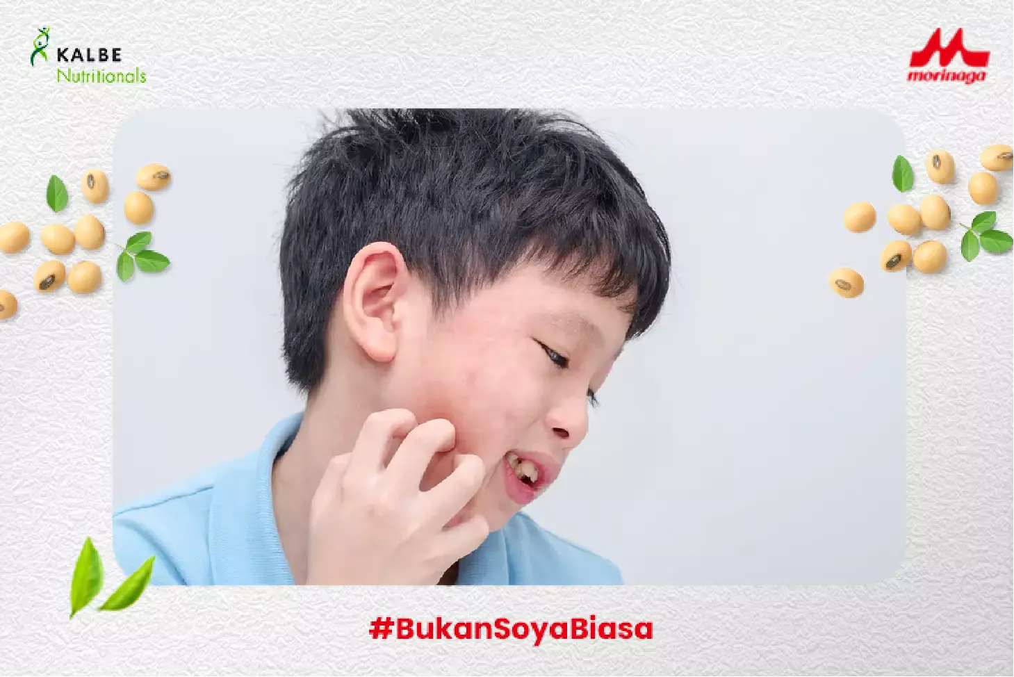 alergi ibuprofen