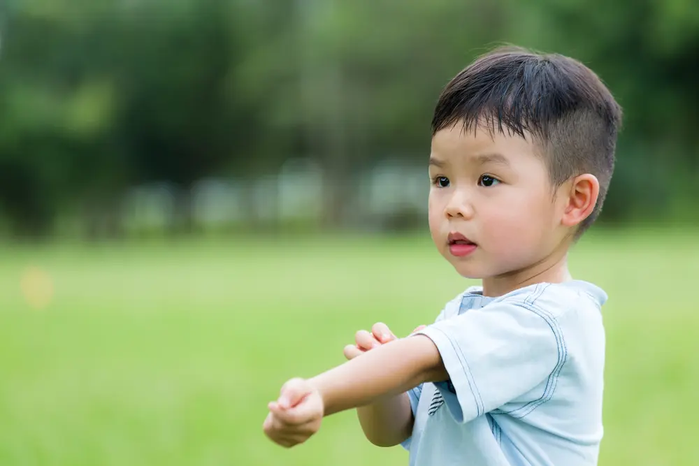 Mengatasi Alergi Kulit pada Si Kecil yang Masih Berusia 1 Tahun 