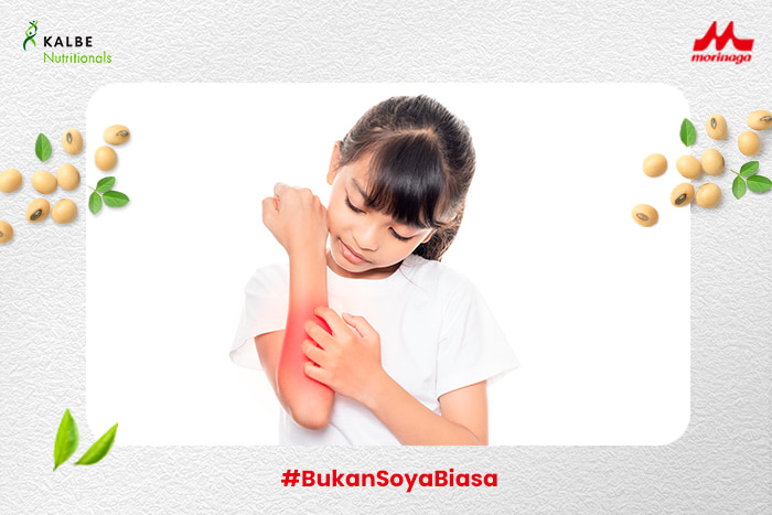 Kenali Perbedaan Biang Keringat dan Alergi