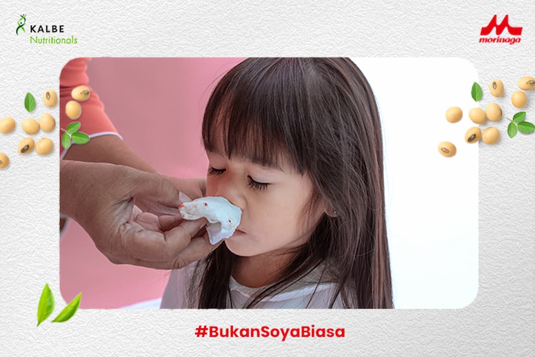 Sering Mimisan pada Anak dan Hubungannya dengan Alergi