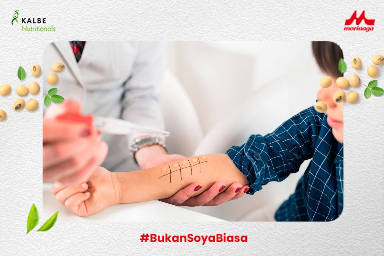 Skin prick test