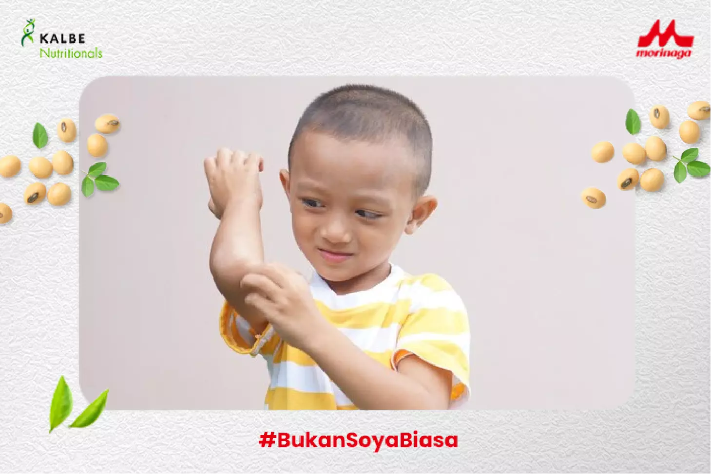 Obat Alergi Kulit dan Cara Alami Mengatasinya