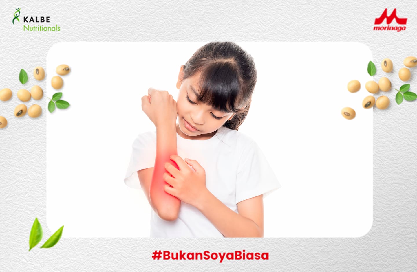 Waspadai Alergi Antibiotik yang Mengganggu pada Si Kecil